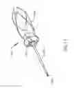 Fig. 15 - System and method for altering rotational alignment of bone sections