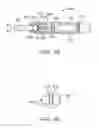 Fig. 24 - System and method for altering rotational alignment of bone sections