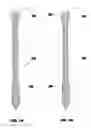 Fig. 11 - Bone end (epiphysis) fracture fixation device and method of use