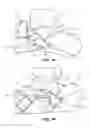 Fig. 02 - Subtalar plate implant