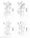 Fig. 05 - Dissection scissors on surgical device