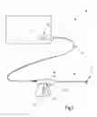 Fig. 02 - Coagulation and dissecting instrument with improved control
