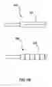 Fig. 06 - Transvascular electrosurgical devices and systems and methods of using the same