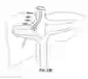 Fig. 22 - Transvascular electrosurgical devices and systems and methods of using the same