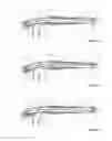 Fig. 07 - Catheter System