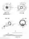 Fig. 02 - METHODS FOR DEFLECTING CATHETERS