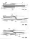 Fig. 06 - METHODS FOR DEFLECTING CATHETERS