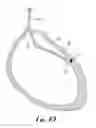 Fig. 05 - Real-time molecular imaging and minimally-invasive detection in interventional cardiology