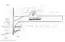 Fig. 01 - Measurement instrument for joint surgery