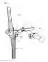 Fig. 02 - Measurement instrument for joint surgery