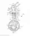 Fig. 04 - FORCE EXERTING ASSEMBLY FOR ORAL IRRIGATING DEVICE