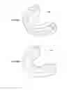 Fig. 05 - Correction device