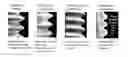 Fig. 01 - SURFACE-MODIFIED HYBRID SURFACE IMPLANT AND METHOD FOR  MANUFACTURING THE SAME