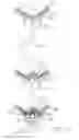 Fig. 16 - Adjustable dental implant