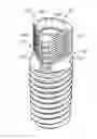 Fig. 01 - Dental implant