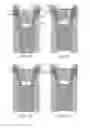 Fig. 04 - Dental implant