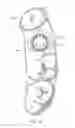 Fig. 05 - Dental implant