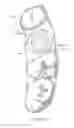 Fig. 15 - Dental implant