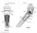 Fig. 14 - Fixed detachable dental attachment device, assembly and methods of using the same