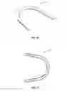 Fig. 17 - Fixed detachable dental attachment device, assembly and methods of using the same