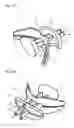 Fig. 02 - BITE REGISTRATION TOOL