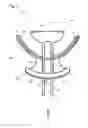 Fig. 04 - BITE REGISTRATION TOOL