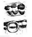 Fig. 03 - Support of removable components in a teeth model manufactured by means of CAM