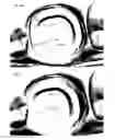 Fig. 06 - Support of removable components in a teeth model manufactured by means of CAM