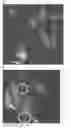Fig. 01 - Textured surfaces for breast implants