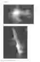 Fig. 06 - Textured surfaces for breast implants