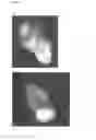 Fig. 07 - Textured surfaces for breast implants