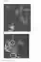 Fig. 09 - Textured surfaces for breast implants