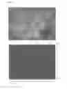 Fig. 23 - Textured surfaces for breast implants