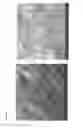 Fig. 26 - Textured surfaces for breast implants