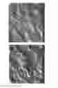 Fig. 27 - Textured surfaces for breast implants