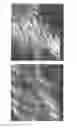 Fig. 28 - Textured surfaces for breast implants