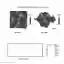 Fig. 58 - Textured surfaces for breast implants