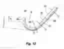 Fig. 13 - Embolus blood clot filter with bio-resorbable coated filter members