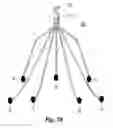 Fig. 15 - Embolus blood clot filter with bio-resorbable coated filter members