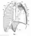 Fig. 02 - METHODS AND DEVICES FOR TREATING A HYPER-INFLATED LUNG