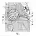 Fig. 05 - METHODS AND DEVICES FOR TREATING A HYPER-INFLATED LUNG