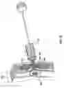 Fig. 16 - METHODS AND DEVICES FOR TREATING A HYPER-INFLATED LUNG