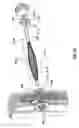 Fig. 22 - METHODS AND DEVICES FOR TREATING A HYPER-INFLATED LUNG