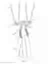 Fig. 03 - Closed loop suture for anchoring tissue grafts