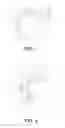 Fig. 07 - Accommodating intraocular lenses