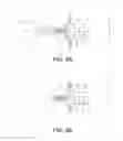 Fig. 08 - Accommodating intraocular lenses
