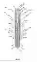 Fig. 02 - Endoprosthesis for implantation in the heart of a patient