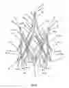Fig. 03 - Endoprosthesis for implantation in the heart of a patient