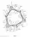Fig. 04 - Endoprosthesis for implantation in the heart of a patient