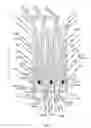 Fig. 06 - Endoprosthesis for implantation in the heart of a patient